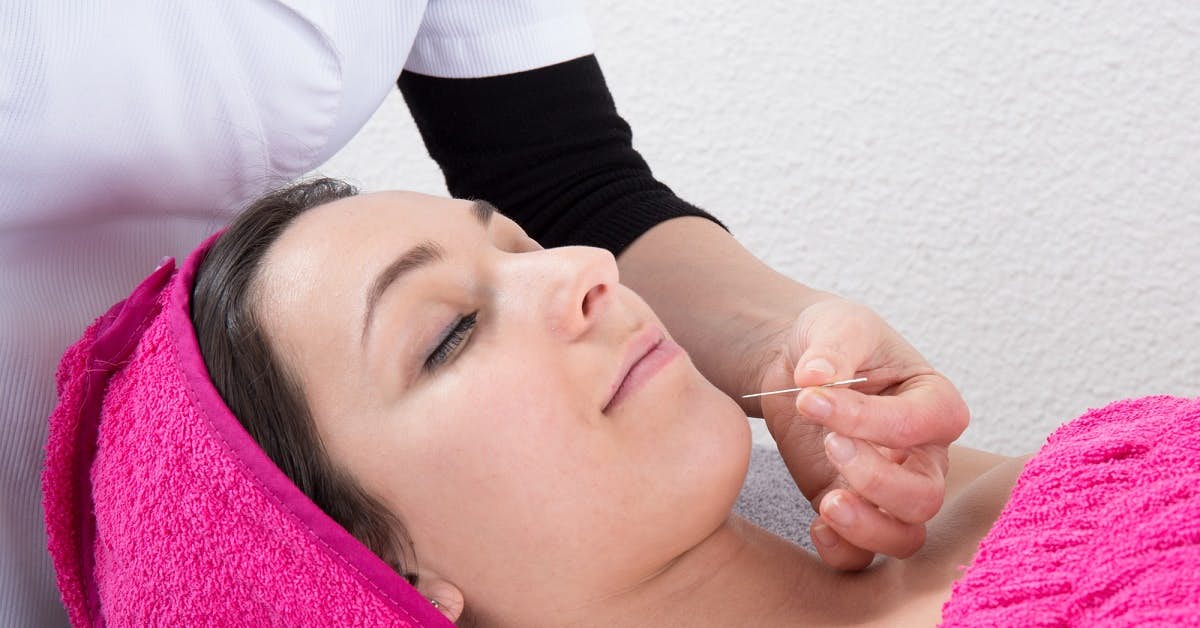 Cosmetic Acupuncture: Has Botox Met Its Match? about undefined