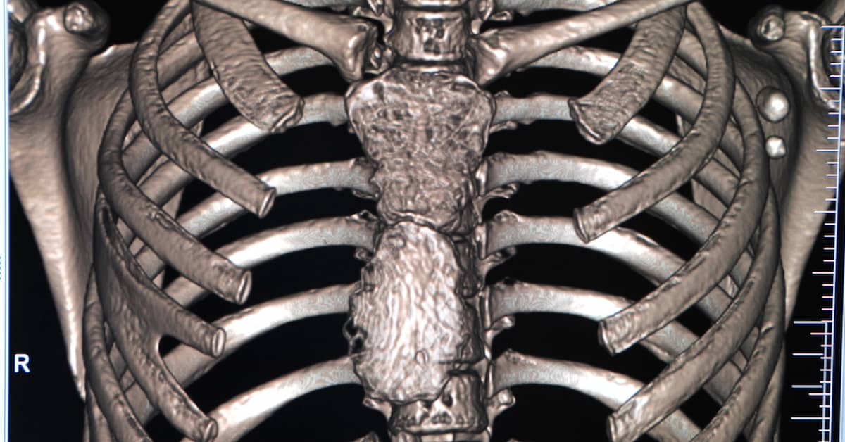 Scientific Surprise Reverses Aging by Rejuvenating the Immune System about undefined